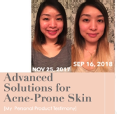 Jessica's Clear Skin Regimen (Topical Solutions) Trend